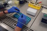 Otázky a odpovede o Q horúčke a súvisiacom výskume v BMC SAV