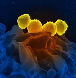 Bacteriophage lytic proteins