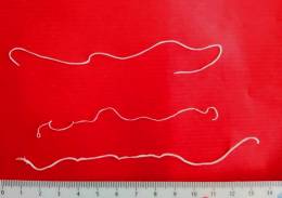 The first case of human infection with the lung worm Dirofilaria immitis was confirmed in Slovakia