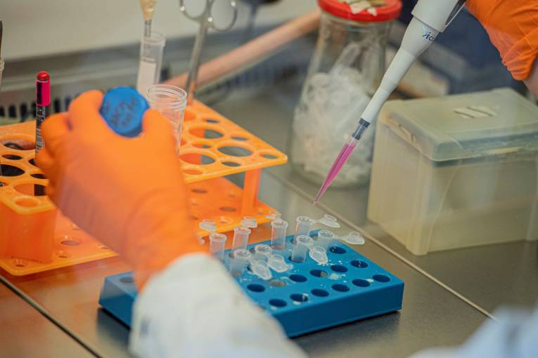Na snímke práca v laminarnom sterilnom boxe s bunkami Virologického ústavu Biomedicínskeho centra SAV