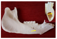 Hope for patients with damaged facial bones - new biomaterial from Košice