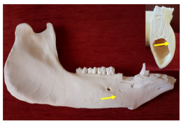 Hope for patients with damaged facial bones - new biomaterial from Košice