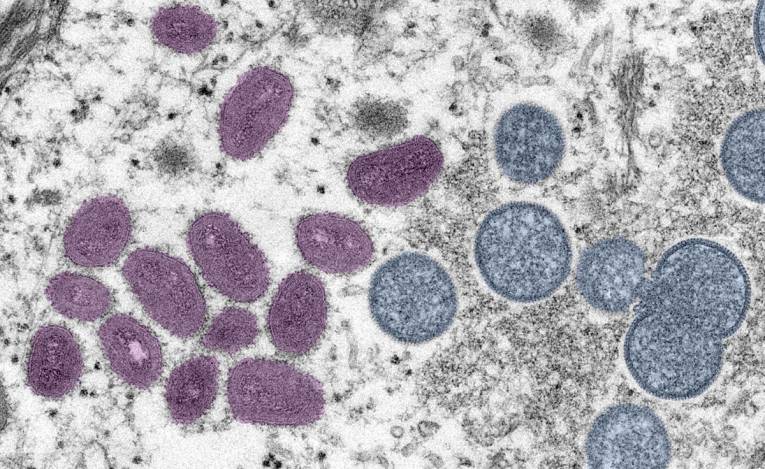 Digitálne dofarbený obrázok znázorňuje vírusové častice vírusu opičích kiahní, ako ich možno pozorovať v elektrónovej mikroskopii. Na ľavej strane sa nachádzajú zrelé vírusové častice oválneho tvaru (dofarbené fialovou farbou) a na pravej strane sú sférické častice nezrelých častíc (dofarbené modrou farbou)