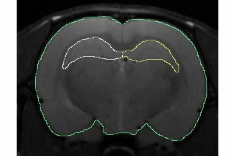 Rez mozgom potkana s vyznačenými hipokampálnymi časťami pomocou magnetickej rezonancie