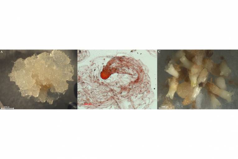A) Embryogénny kalus Pinus nigra
B) Bipolárne somatické embryo (farbené acetokarmínom)
C) Kotyledonárne somatické embryá
